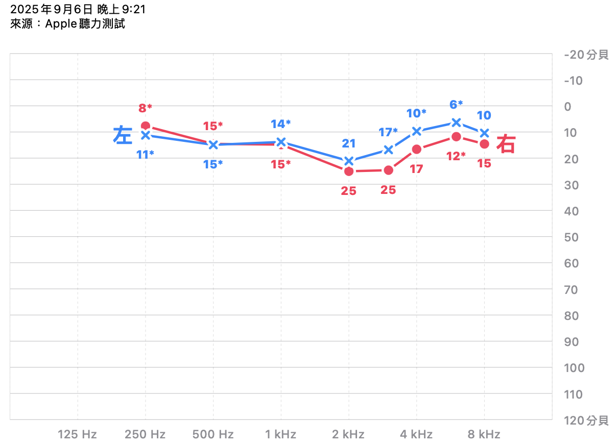 以 Apple Airpods Pro 2 測量的我的聽力圖